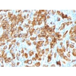 Immunohistochemistry - Anti-MelanA Antibody [SPM540] - BSA and Azide free (A251738) - Antibodies.com