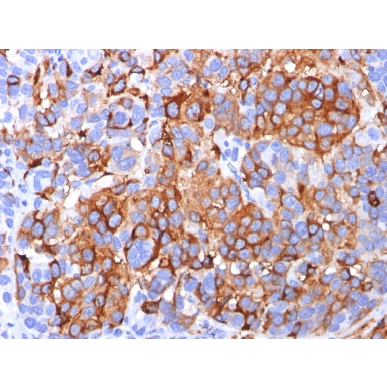Immunohistochemistry - Anti-MelanA Antibody [A103] - BSA and Azide free (A251739) - Antibodies.com