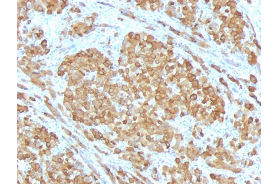 Immunohistochemistry - Anti-MelanA Antibody [SPM555] - BSA and Azide free (A251740) - Antibodies.com