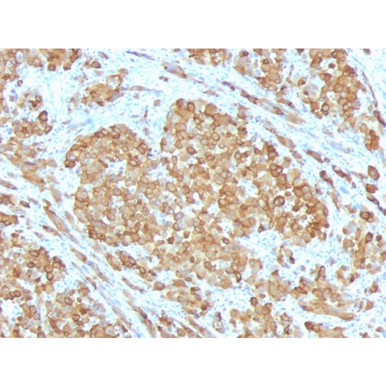 Immunohistochemistry - Anti-MelanA Antibody [SPM555] - BSA and Azide free (A251740) - Antibodies.com