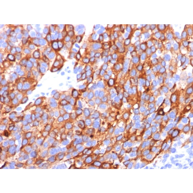 Immunohistochemistry - Anti-MelanA Antibody [A103 + M2-7C10 + M2-9E3] - BSA and Azide free (A251741) - Antibodies.com
