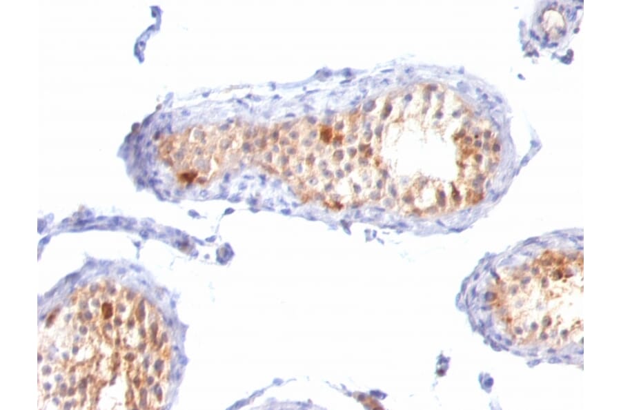 Immunohistochemistry - Anti-MelanA Antibody [A103 + M2-7C10 + M2-9E3] - BSA and Azide free (A251742) - Antibodies.com