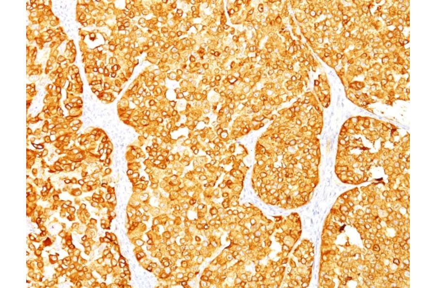 Immunohistochemistry - Anti-MelanA Antibody [M2-7C10 + M2-9E3] - BSA and Azide free (A251742) - Antibodies.com