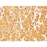 Immunohistochemistry - Anti-MelanA Antibody [DT101 + BC199] - BSA and Azide free (A251744) - Antibodies.com