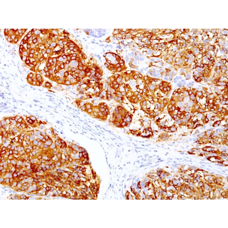 Immunohistochemistry - Anti-MelanA Antibody [DT101 + BC199] - BSA and Azide free (A251743) - Antibodies.com