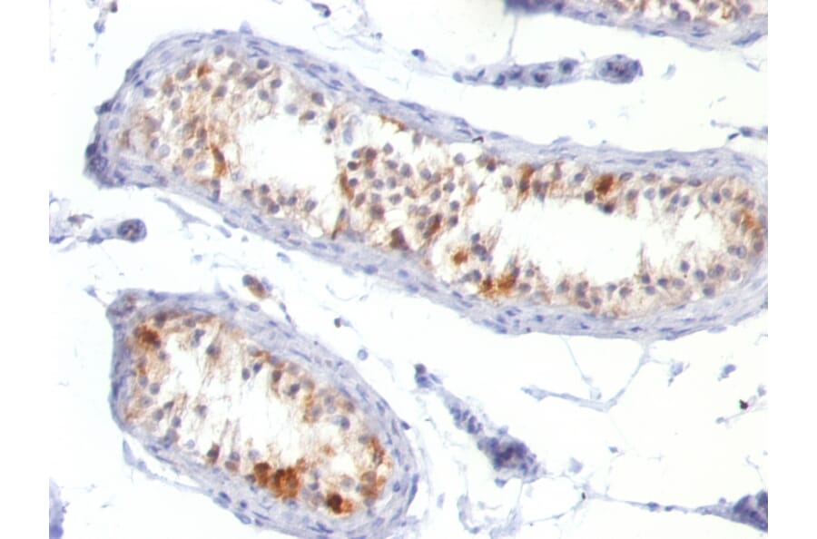 Immunohistochemistry - Anti-MelanA Antibody [MLANA/788] - BSA and Azide free (A251745) - Antibodies.com