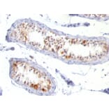 Immunohistochemistry - Anti-MelanA Antibody [MLANA/788] - BSA and Azide free (A251745) - Antibodies.com