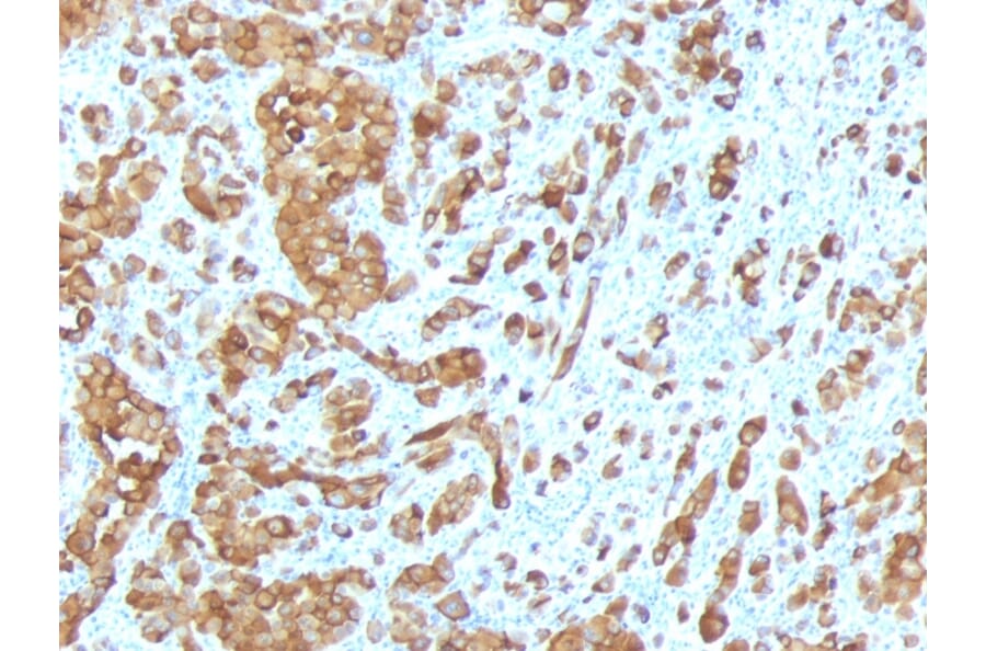 Immunohistochemistry - Anti-MelanA Antibody [MLANA/788] - BSA and Azide free (A251744) - Antibodies.com