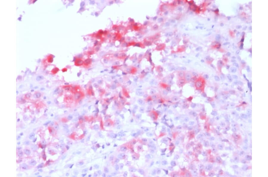 Immunohistochemistry - Anti-MelanA Antibody [MLANA/1761R] - BSA and Azide free (A251745) - Antibodies.com