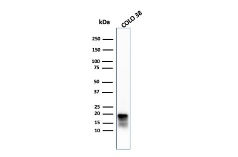 Western Blot - Anti-MelanA Antibody [MLANA/4385R] - BSA and Azide free (A251747) - Antibodies.com