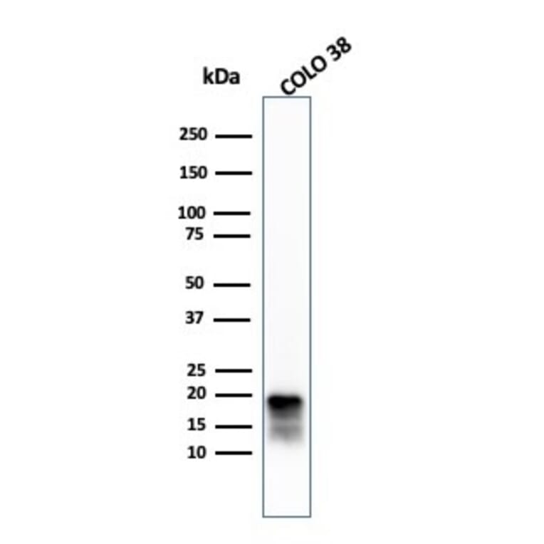 Western Blot - Anti-MelanA Antibody [MLANA/4385R] - BSA and Azide free (A251747) - Antibodies.com