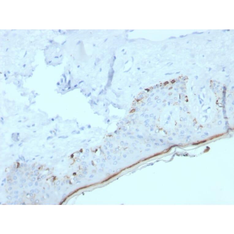 Immunohistochemistry - Anti-MelanA Antibody [MLANA/4385R] - BSA and Azide free (A251746) - Antibodies.com