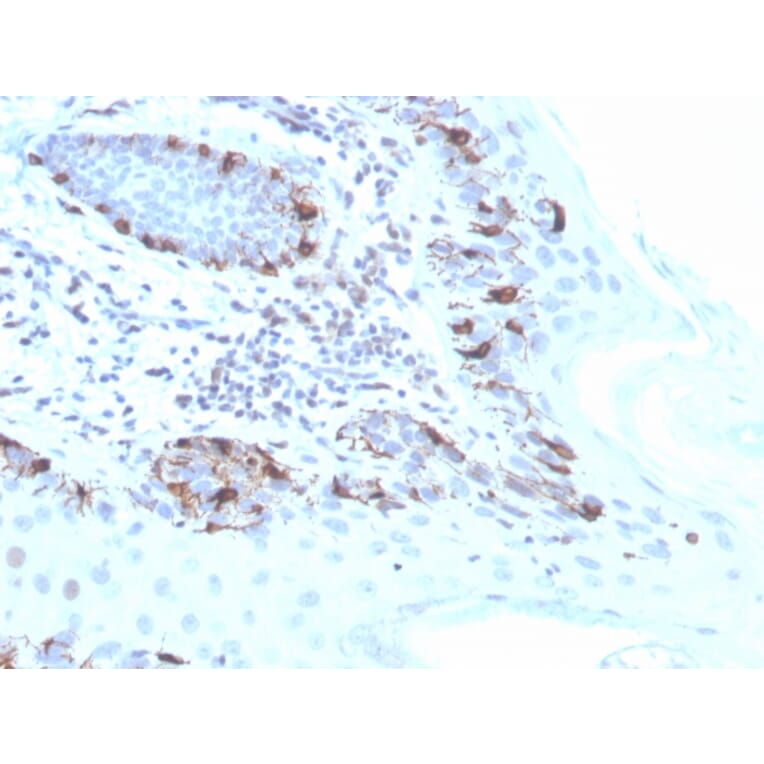 Immunohistochemistry - Anti-MelanA Antibody [MLANA/4475R] - BSA and Azide free (A251748) - Antibodies.com