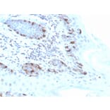 Immunohistochemistry - Anti-MelanA Antibody [MLANA/4475R] - BSA and Azide free (A251748) - Antibodies.com