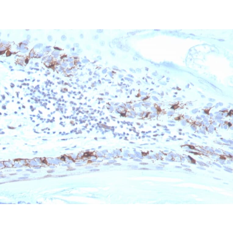 Immunohistochemistry - Anti-MelanA Antibody [MLANA/4475R] - BSA and Azide free (A248566) - Antibodies.com