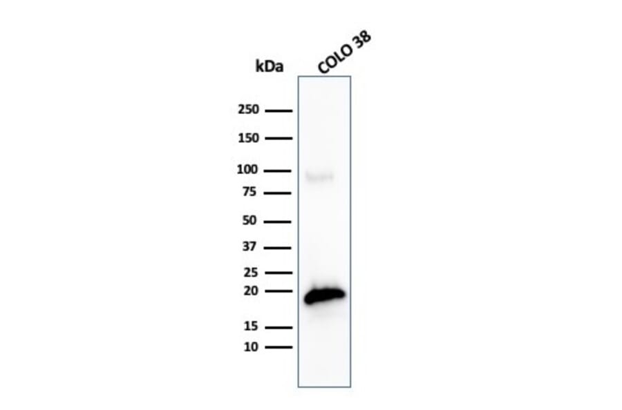 Western Blot - Anti-MelanA Antibody [MLANA/4475R] - BSA and Azide free (A248566) - Antibodies.com