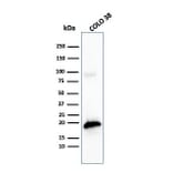 Western Blot - Anti-MelanA Antibody [MLANA/4475R] - BSA and Azide free (A248566) - Antibodies.com
