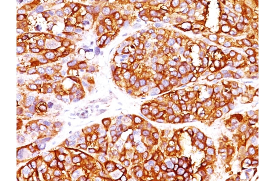 Immunohistochemistry - Anti-MelanA Antibody [MLANA/1409R] - BSA and Azide free (A251748) - Antibodies.com