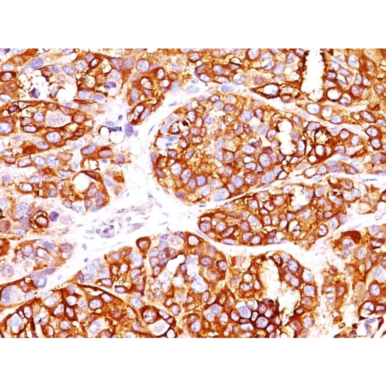 Immunohistochemistry - Anti-MelanA Antibody [MLANA/1409R] - BSA and Azide free (A251748) - Antibodies.com