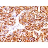 Immunohistochemistry - Anti-MelanA Antibody [MLANA/1409R] - BSA and Azide free (A251748) - Antibodies.com
