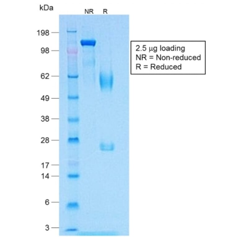 SDS-PAGE - Anti-MelanA Antibody [MLANA/1409R] - BSA and Azide free (A251749) - Antibodies.com