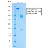 SDS-PAGE - Anti-MelanA Antibody [MLANA/1409R] - BSA and Azide free (A251749) - Antibodies.com