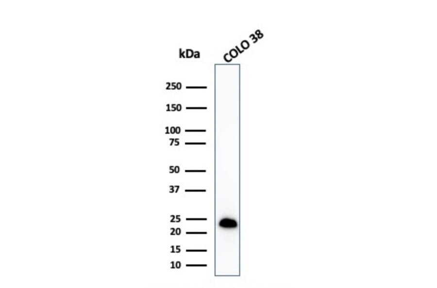 Western Blot - Anti-MelanA Antibody [MLANA/1409R] - BSA and Azide free (A251749) - Antibodies.com