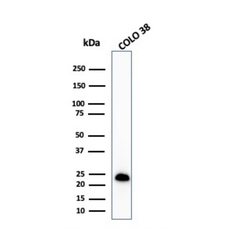 Western Blot - Anti-MelanA Antibody [MLANA/1409R] - BSA and Azide free (A251749) - Antibodies.com