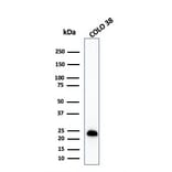 Western Blot - Anti-MelanA Antibody [MLANA/1409R] - BSA and Azide free (A251749) - Antibodies.com