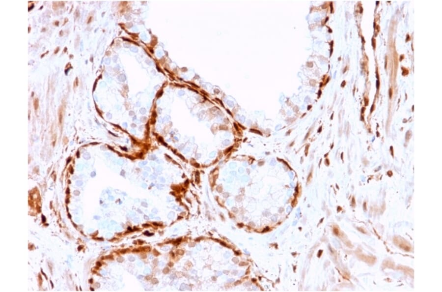 Immunohistochemistry - Anti-AKR1B1 Antibody [CPTC-AKR1B1-3] - BSA and Azide free (A251751) - Antibodies.com