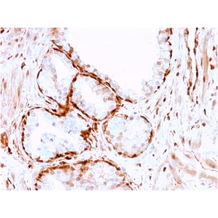 Immunohistochemistry - Anti-AKR1B1 Antibody [CPTC-AKR1B1-3] - BSA and Azide free (A251751) - Antibodies.com