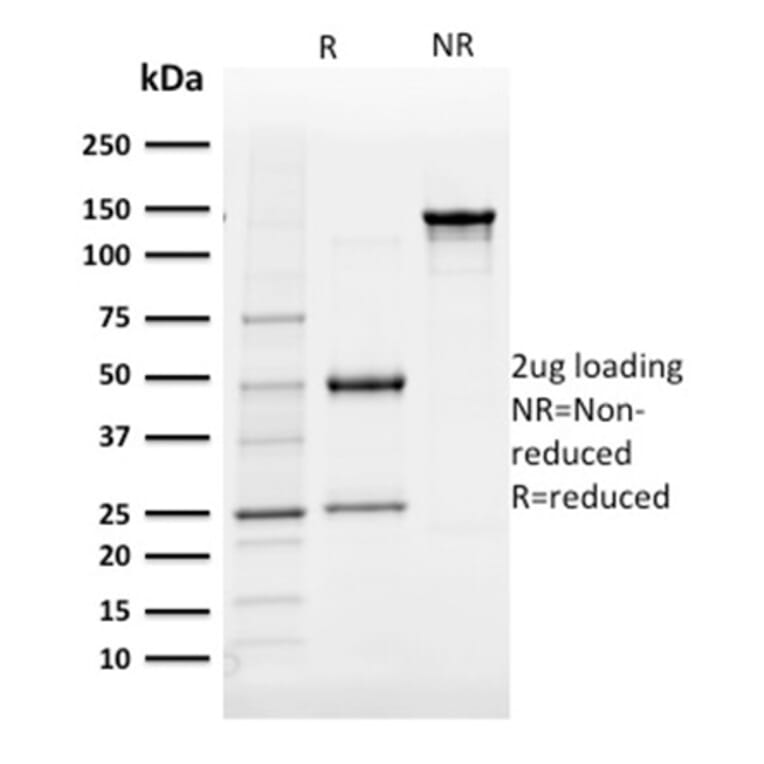 SDS-PAGE - Anti-AKR1B1 Antibody [CPTC-AKR1B1-3] - BSA and Azide free (A251751) - Antibodies.com