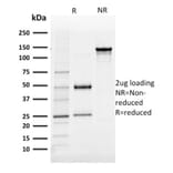 SDS-PAGE - Anti-AKR1B1 Antibody [CPTC-AKR1B1-3] - BSA and Azide free (A251751) - Antibodies.com