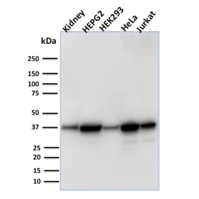 Western Blot - Anti-AKR1B1 Antibody [CPTC-AKR1B1-3] - BSA and Azide free (A251751) - Antibodies.com