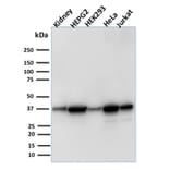 Western Blot - Anti-AKR1B1 Antibody [CPTC-AKR1B1-3] - BSA and Azide free (A251751) - Antibodies.com