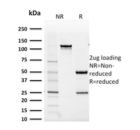 SDS-PAGE - Anti-AKR1B1 Antibody [CPTC-AKR1B1-2] - BSA and Azide free (A251752) - Antibodies.com