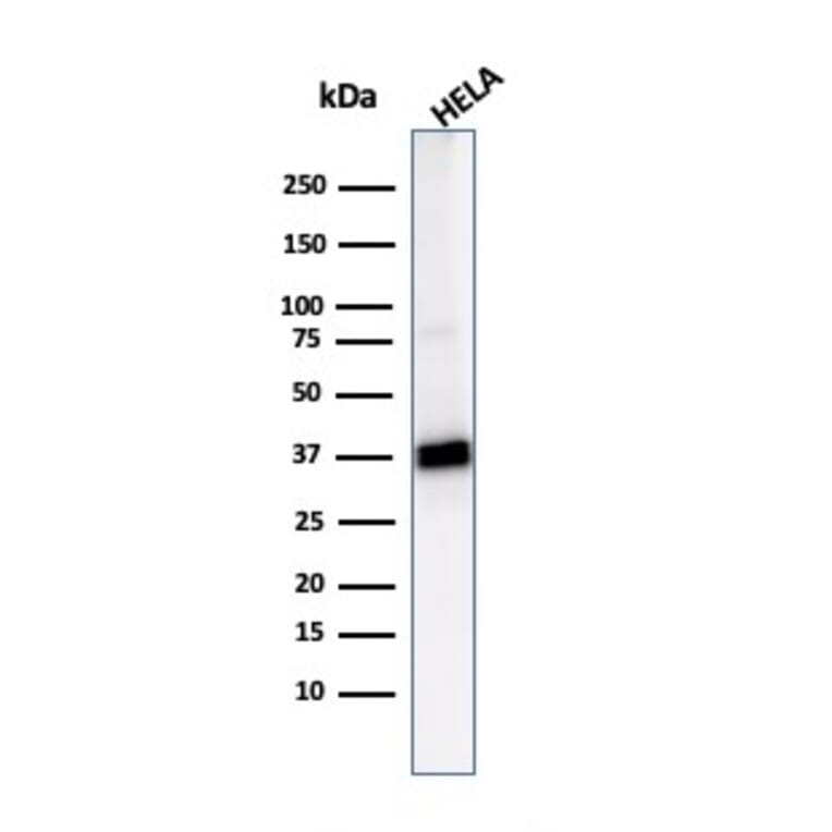 Western Blot - Anti-AKR1B1 Antibody [CPTC-AKR1B1-2] - BSA and Azide free (A251752) - Antibodies.com