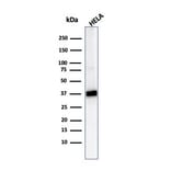 Western Blot - Anti-AKR1B1 Antibody [CPTC-AKR1B1-2] - BSA and Azide free (A251752) - Antibodies.com