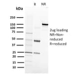 SDS-PAGE - Anti-VEGF Receptor 1 Antibody [FLT1/658] - BSA and Azide free (A251752) - Antibodies.com