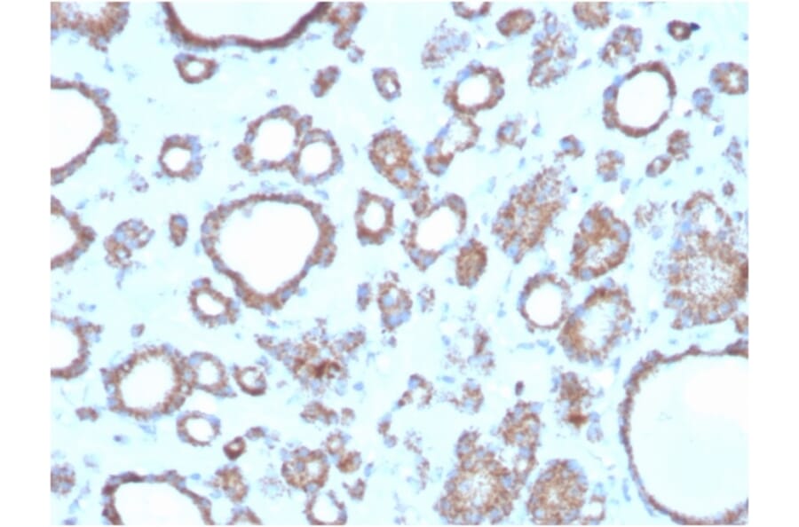 Immunohistochemistry - Anti-DBC2 Antibody [DBC2/3362] - BSA and Azide free (A251754) - Antibodies.com