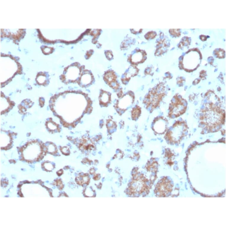 Immunohistochemistry - Anti-DBC2 Antibody [DBC2/3362] - BSA and Azide free (A251754) - Antibodies.com