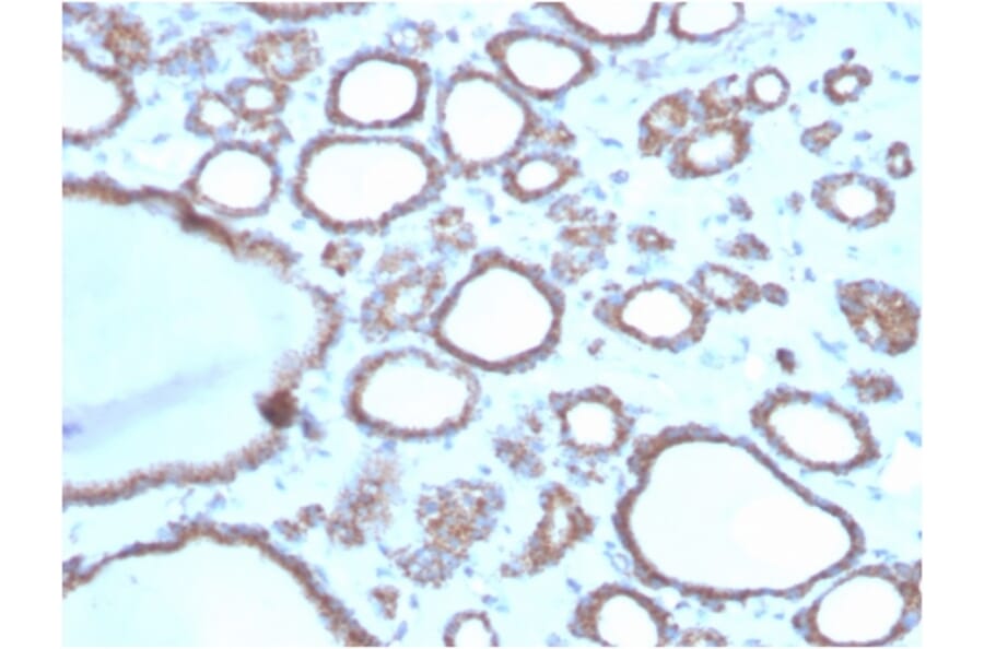 Immunohistochemistry - Anti-DBC2 Antibody [DBC2/3362] - BSA and Azide free (A251754) - Antibodies.com