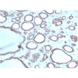 Immunohistochemistry - Anti-DBC2 Antibody [DBC2/3362] - BSA and Azide free (A251754) - Antibodies.com