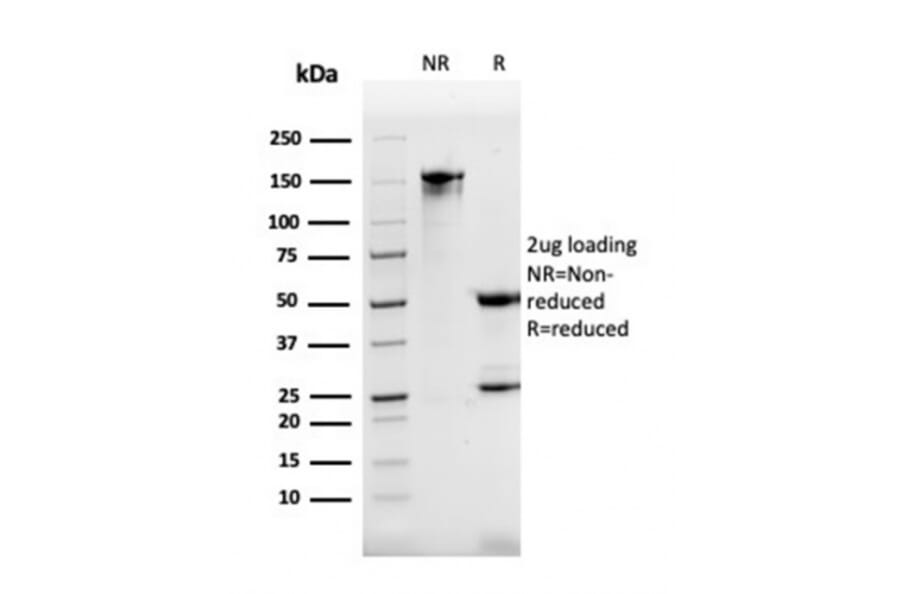 SDS-PAGE - Anti-DBC2 Antibody [DBC2/3362] - BSA and Azide free (A251754) - Antibodies.com