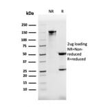 SDS-PAGE - Anti-DBC2 Antibody [DBC2/3362] - BSA and Azide free (A251754) - Antibodies.com