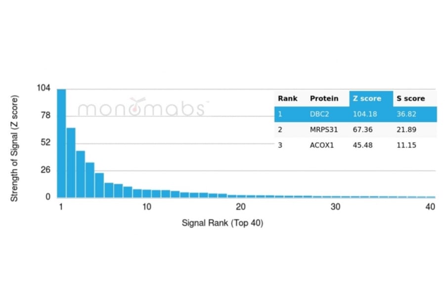 Protein Array - Anti-DBC2 Antibody [DBC2/3362] - BSA and Azide free (A251753) - Antibodies.com