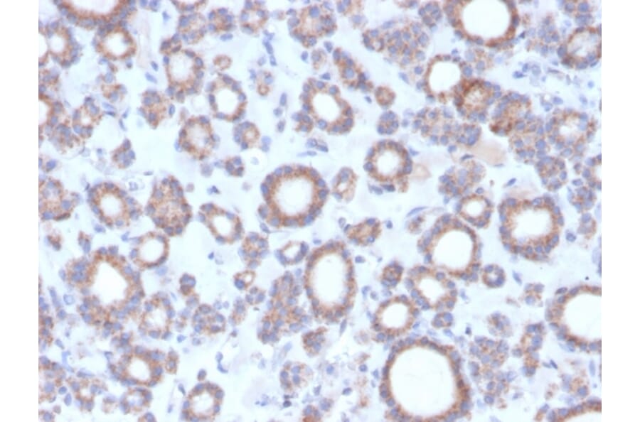 Immunohistochemistry - Anti-DBC2 Antibody [DBC2/3364] - BSA and Azide free (A251755) - Antibodies.com