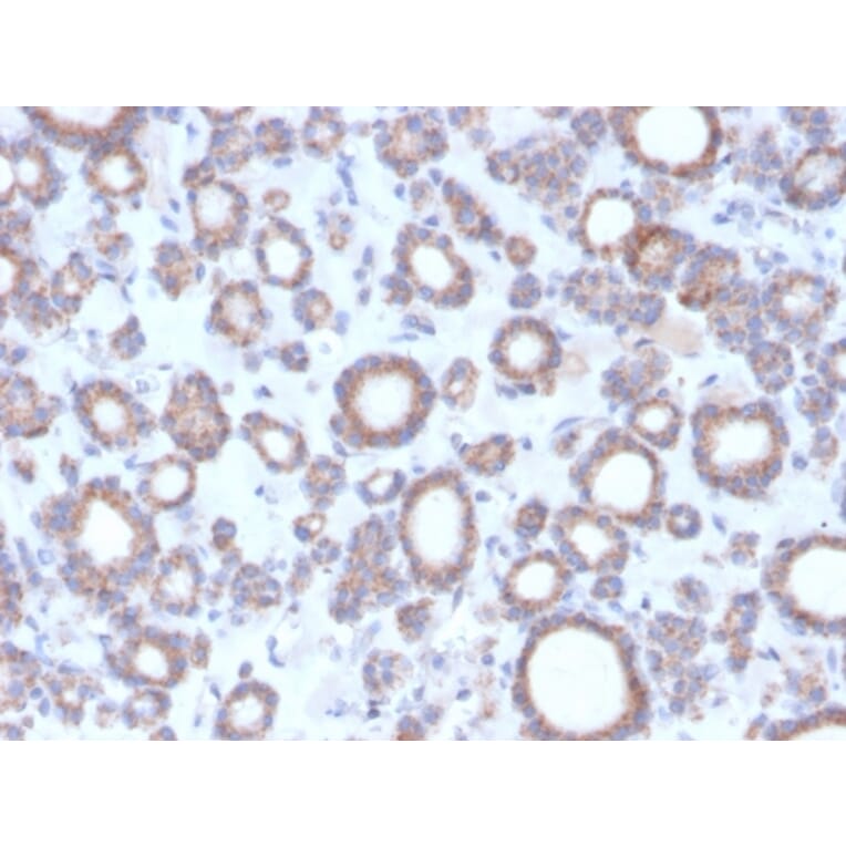 Immunohistochemistry - Anti-DBC2 Antibody [DBC2/3364] - BSA and Azide free (A251755) - Antibodies.com