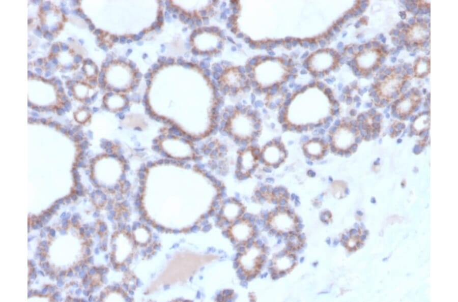 Immunohistochemistry - Anti-DBC2 Antibody [DBC2/3364] - BSA and Azide free (A251755) - Antibodies.com