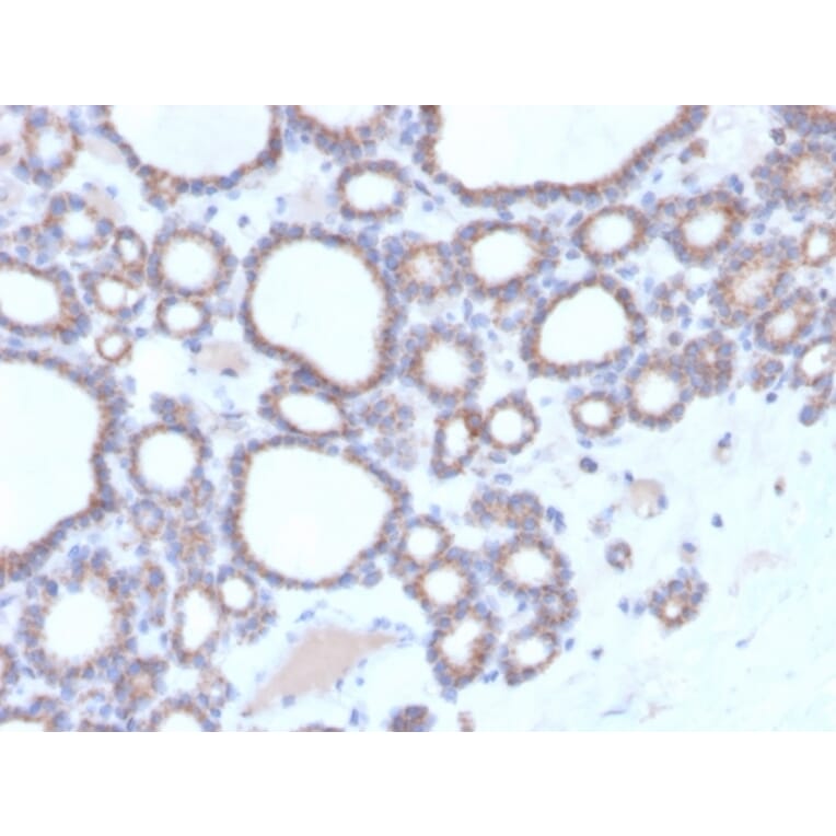 Immunohistochemistry - Anti-DBC2 Antibody [DBC2/3364] - BSA and Azide free (A251755) - Antibodies.com
